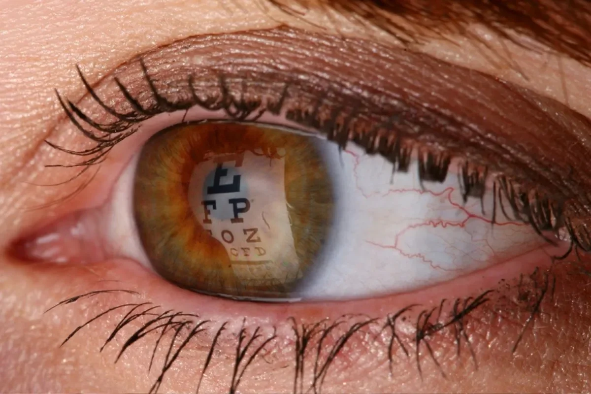 Oftalmólogos argentinos destacan en el ámbito internacional por técnica revolucionaria en cirugía de retina
